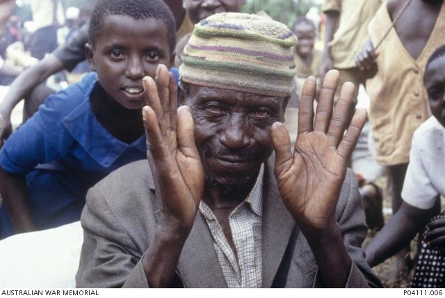 A Rwandan man who survived the massacre makes a gesture of relief after the carnage (photo George Gittoes)