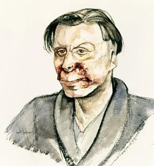 Face Burns, Sgt James F. Gourley, RAF, 536215