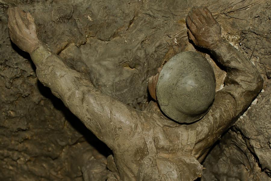 After treatment: figure with right forearm reattached